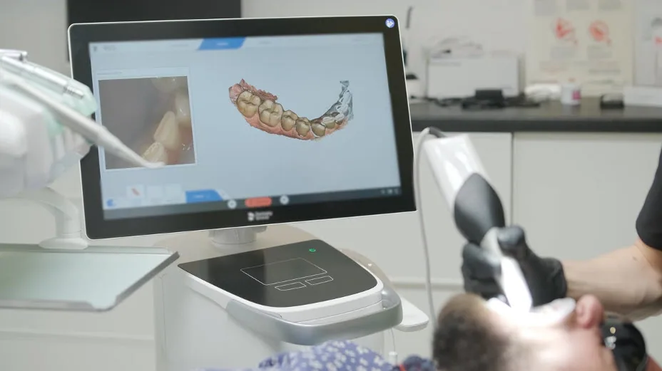 iTero Digital Scanning at Willow Dental Group