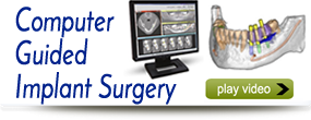 computer-guided-dental-implants