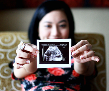 How Pregnancy Affects Your Oral Health