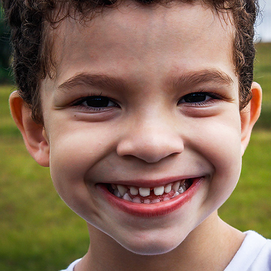 Is Your Frenulum Holding You Back?