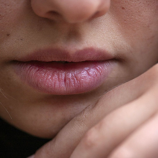 Temporomandibular Disorders