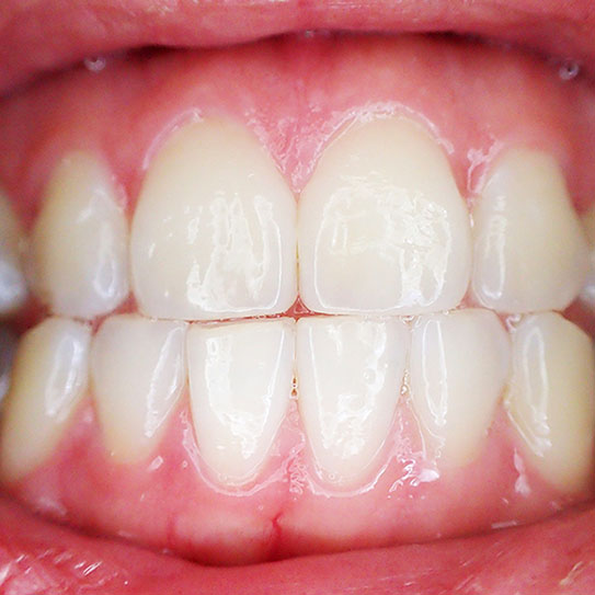 A Closer Look At Our Teeth