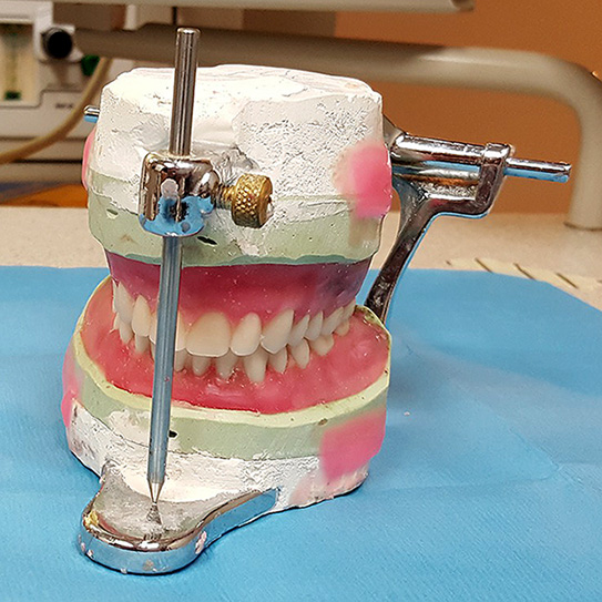 DENTURES THROUGH HISTORY
