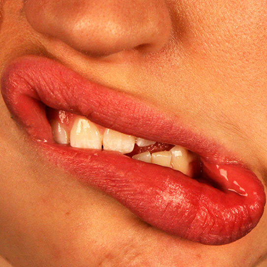 BLEEDING GUMS: CAUSES AND TREATMENT